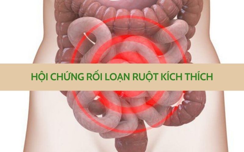 Hội chứng ruột kích thích