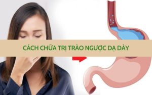 Trào ngược dạ dày